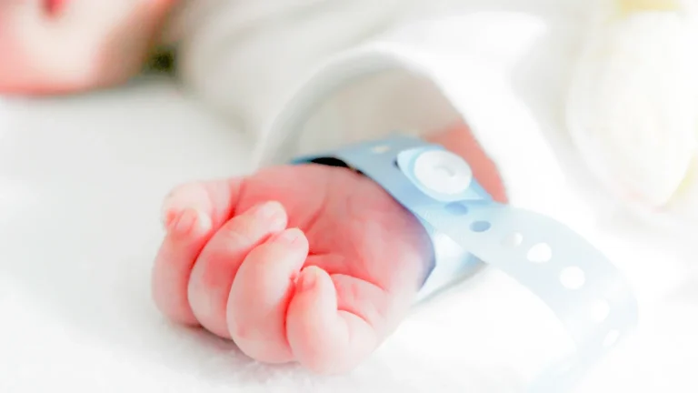 post nicu discharge feeding